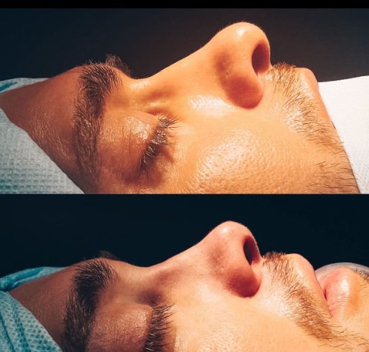 &#128067;